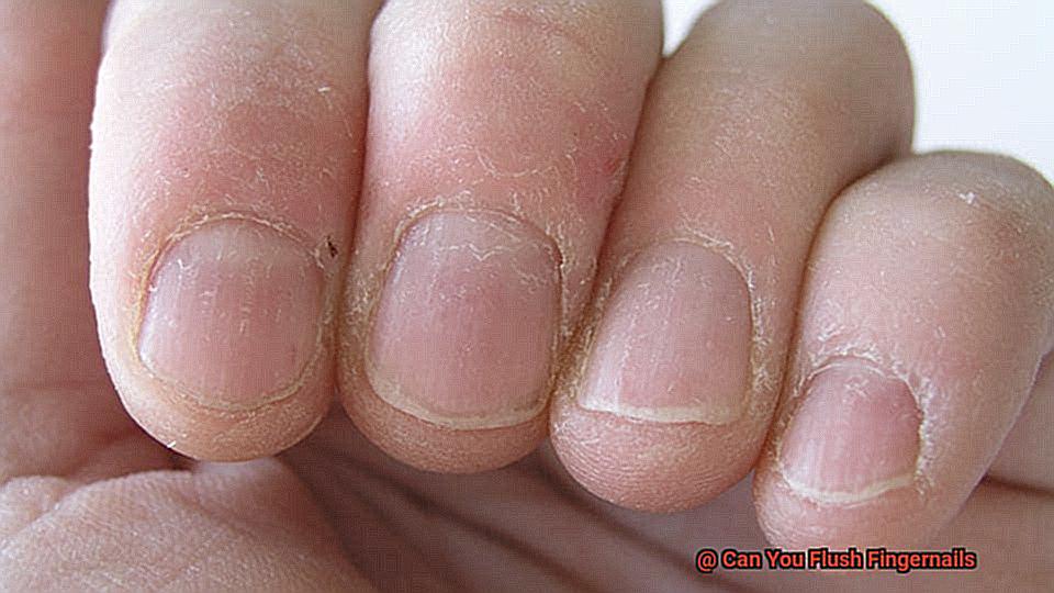 Can You Flush Fingernails-4